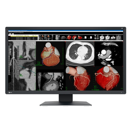 EIZO RadiForce MX317W computer monitor 77.5 cm (30.5") 4096 x 2160 pixels 4K DCI LCD Black - MX317W
