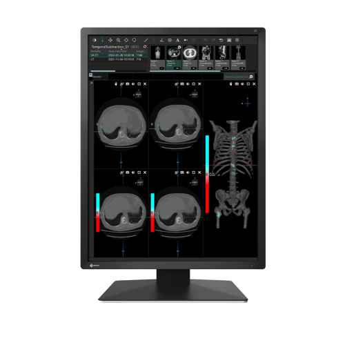 EIZO RadiForce MX217A-BK Clinical Review 21.3" 2MP